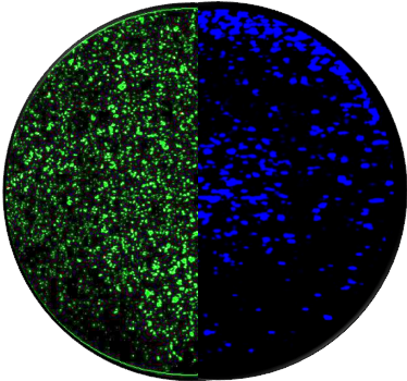 Application GFP/DAPI-expressed virus infected